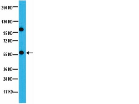 Anti-PP2A-B&#8217; (B56) Antibody from rabbit