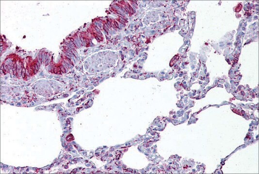 Anti-GABRB3 antibody produced in rabbit affinity isolated antibody