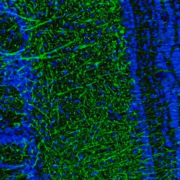 Anti-DPP6 antibody produced in rabbit Prestige Antibodies&#174; Powered by Atlas Antibodies, affinity isolated antibody, buffered aqueous glycerol solution