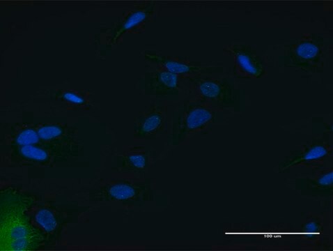 Anti-IFIT2 antibody produced in mouse purified immunoglobulin, buffered aqueous solution