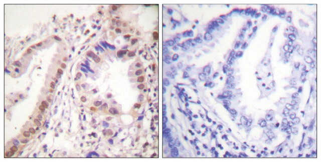 Anti-Estrogen Receptor-&#945;, C-Terminal antibody produced in rabbit affinity isolated antibody