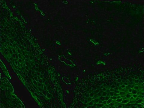 Anti-Lectin, Ulex europaeus-I antibody produced in rabbit whole antiserum, delipidized