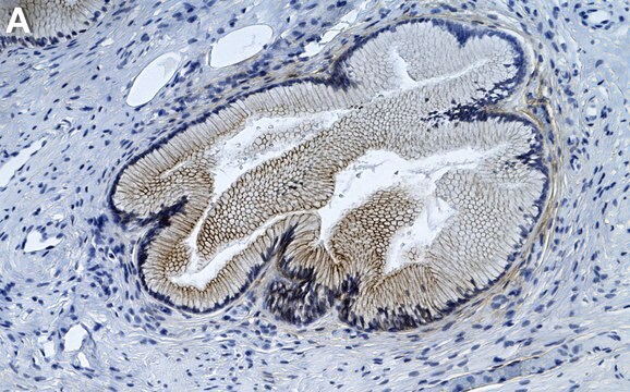 Anti-Phospho-EGFR (Tyr1068) Antibody, clone 3F4 ZooMAb&#174; Rabbit Monoclonal recombinant, expressed in HEK 293 cells