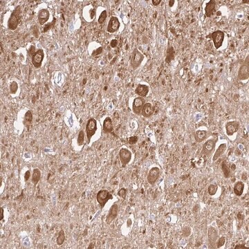 Anti-CAMK2A antibody produced in rabbit Prestige Antibodies&#174; Powered by Atlas Antibodies, affinity isolated antibody, buffered aqueous glycerol solution