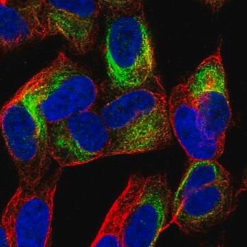 Anti-TBC1D16 antibody produced in rabbit Prestige Antibodies&#174; Powered by Atlas Antibodies, affinity isolated antibody