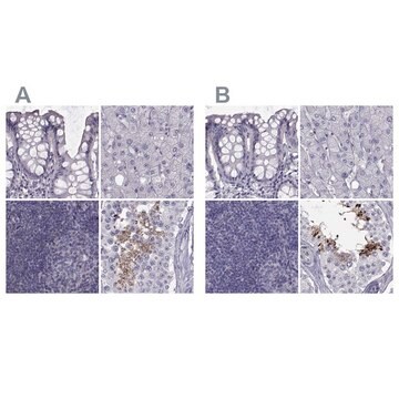 Anti-FAM71B antibody produced in rabbit Prestige Antibodies&#174; Powered by Atlas Antibodies, affinity isolated antibody, buffered aqueous glycerol solution