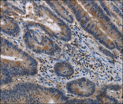 Anti-ITPR2 antibody produced in rabbit affinity isolated antibody