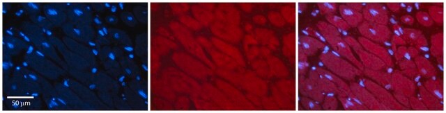 Anti-MLXIP antibody produced in rabbit affinity isolated antibody