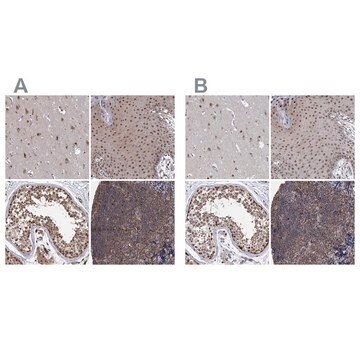 Anti-PSMD4 antibody produced in rabbit Prestige Antibodies&#174; Powered by Atlas Antibodies, affinity isolated antibody, buffered aqueous glycerol solution