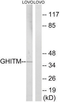 Anti-GHITM antibody produced in rabbit affinity isolated antibody