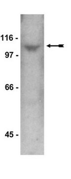 Anti-STAT2 Antibody, CT Upstate&#174;, from rabbit