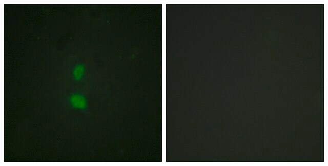 Anti-phospho-SNAI1 (pSer246) antibody produced in rabbit affinity isolated antibody