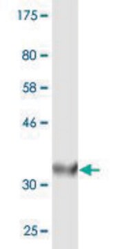 Monoclonal Anti-ACOX2, (C-terminal) antibody produced in mouse clone 1A7, purified immunoglobulin, buffered aqueous solution