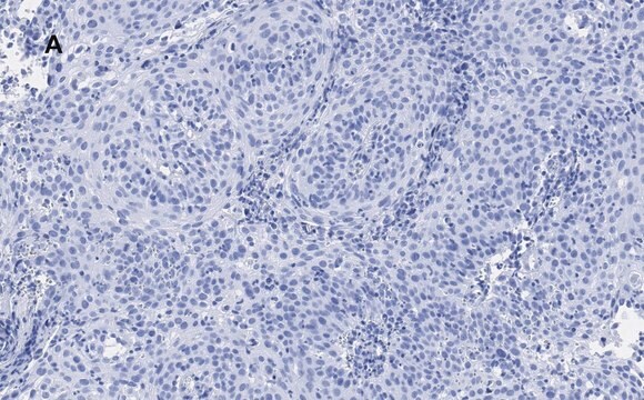 Anti-p21 Antibody, clone 5G7, ZooMAb&#174; Rabbit Monoclonal recombinant, expressed in HEK 293 cells