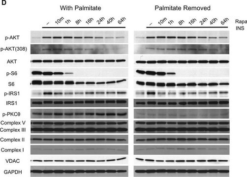 Anti-IRS1 Antibody, clone 4.2.2 clone 4.2.2, from mouse