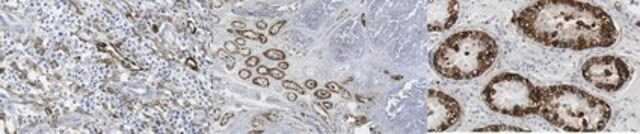 Anti-Podoplanin Antibody, clone LpMab-17 clone LpMab-17, from mouse