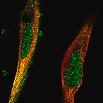 Anti-TRIM36 antibody produced in rabbit Prestige Antibodies&#174; Powered by Atlas Antibodies, affinity isolated antibody