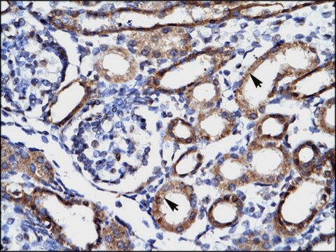 Anti-FHL1 antibody produced in rabbit IgG fraction of antiserum