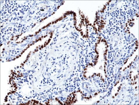 Anti-TTF1 (Thyroid transcription factor 1) antibody, Rabbit monoclonal recombinant, expressed in HEK 293 cells, clone RM373, purified immunoglobulin