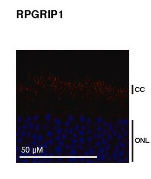 Anti-RPGRIP1 from rabbit