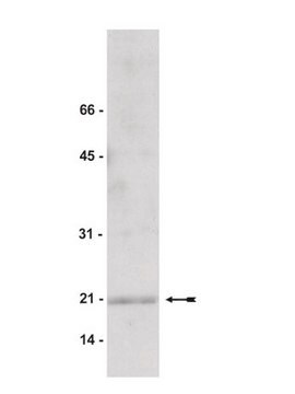 Anti-Cofilin 2 Antibody Upstate&#174;, from rabbit