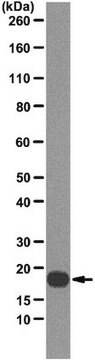 Anti-Interleukin-1 beta (IL-1B) Antibody, clone 4A7 clone AB34_41.4H12.4A7, from mouse