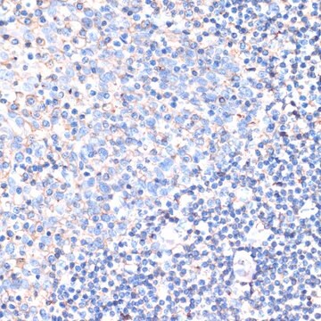 Anti-CD44 antibody produced in rabbit