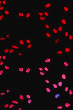 Anti-Phospho-CCNE1-T395 antibody produced in rabbit