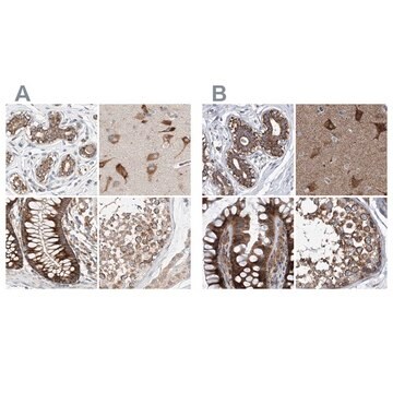 Anti-ZC3H15 antibody produced in rabbit Prestige Antibodies&#174; Powered by Atlas Antibodies, affinity isolated antibody, buffered aqueous glycerol solution, ab2