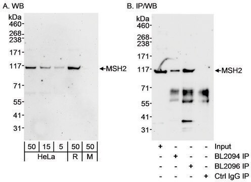 Rabbit anti-MSH2 Antibody, Affinity Purified Powered by Bethyl Laboratories, Inc.