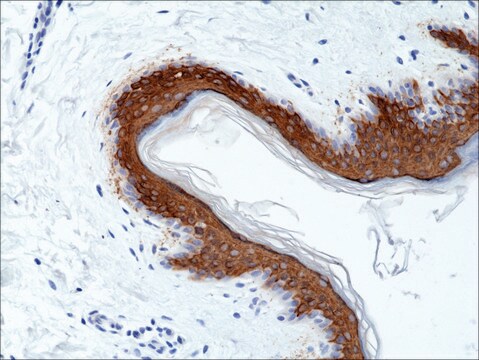 Anti-Cytokeratin 10 (CK-10) antibody, Rabbit monoclonal recombinant, expressed in HEK 293 cells, clone RM386, purified immunoglobulin