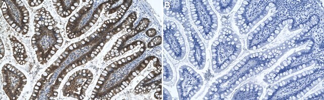 Anti-AKR1C3 Antibody, clone 1I9 ZooMAb&#174; Rabbit Monoclonal recombinant, expressed in HEK 293 cells