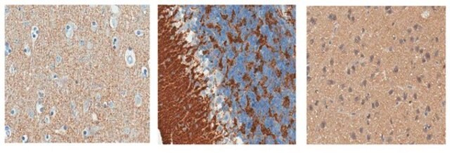 Anti-Synapsin-2 Antibody, clone 19.4 clone 19.4, from mouse