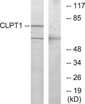 Anti-CLPT1 antibody produced in rabbit affinity isolated antibody