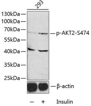 Anti-Phospho-AKT2-S474 antibody produced in rabbit