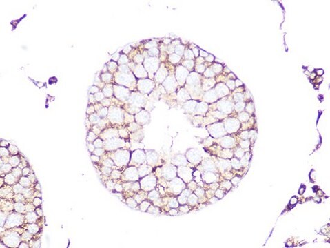 Anti-RHOA/RHOB/RHOC antibody produced in rabbit