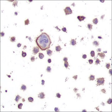 Anti-N-RAS antibody, Rabbit monoclonal recombinant, expressed in proprietary host, clone SP174, affinity isolated antibody