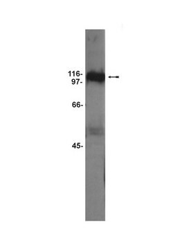 Anti-GluR5 Antibody Upstate&#174;, from rabbit