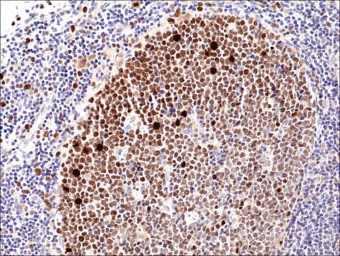 Anti-KI67 antibody, Rabbit monoclonal recombinant, expressed in HEK 293 cells, clone RM360, purified immunoglobulin