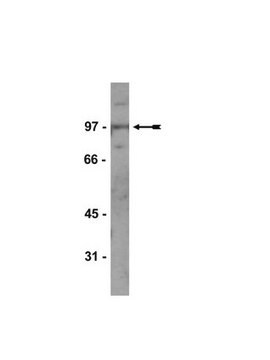 Anti-Kaiso Antibody, clone 6F clone 6F, Upstate&#174;, from mouse