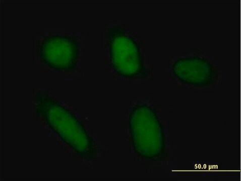 Anti-ANXA5 antibody produced in mouse purified immunoglobulin, buffered aqueous solution