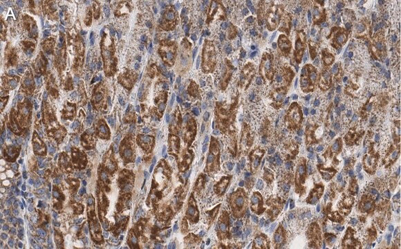 Anti-PNPT1 Antibody, clone 2D23 ZooMAb&#174; Rabbit Monoclonal recombinant, expressed in HEK 293 cells