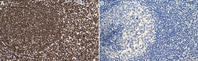 Anti-DNA Antibody, double stranded, clone AE-2 clone AE-2, Chemicon&#174;, from mouse