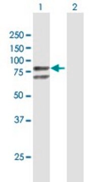 Anti-GLB1 antibody produced in mouse purified immunoglobulin, buffered aqueous solution