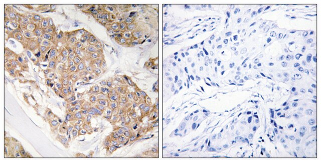 Anti-IL-13R antibody produced in rabbit affinity isolated antibody