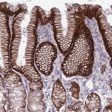 Anti-SUCO antibody produced in rabbit Prestige Antibodies&#174; Powered by Atlas Antibodies, affinity isolated antibody, buffered aqueous glycerol solution