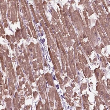 Anti-XK antibody produced in rabbit Prestige Antibodies&#174; Powered by Atlas Antibodies, affinity isolated antibody, buffered aqueous glycerol solution