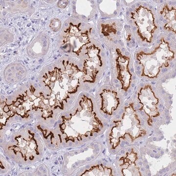 Anti-CHSY1 antibody produced in rabbit Prestige Antibodies&#174; Powered by Atlas Antibodies, affinity isolated antibody, buffered aqueous glycerol solution