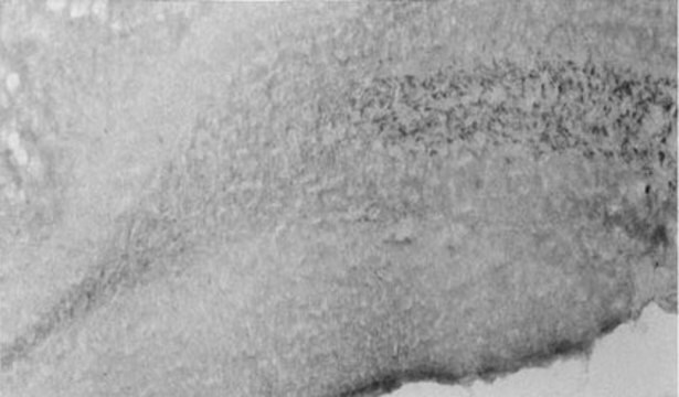 Anti-Sodium Channel Antibody, Voltage Gated, Brain Type II Chemicon&#174;, from rabbit