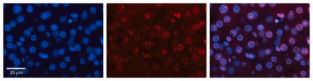 Anti-RUNX1T1 antibody produced in rabbit affinity isolated antibody